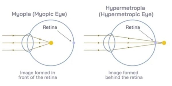 Eye Diagram GCSE Biology | Explained with Examples
