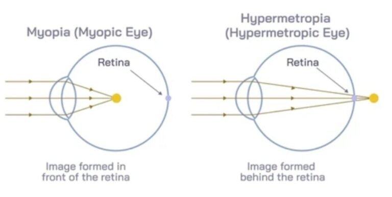 Eye Diagram GCSE Biology | Explained with Examples