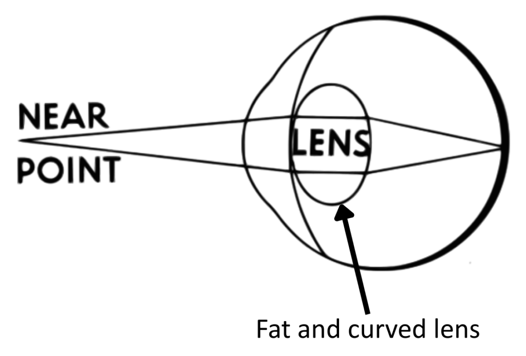 Eye Diagram GCSE showing near point focusing and how the lens bends light rays
